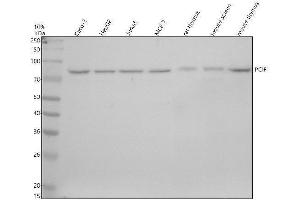 anti-PDX1 C-terminal Inhibiting Factor 1 (PCIF1) (Middle Region) antibody