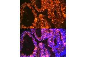Immunofluorescence analysis of human ovary using Lin28 Rabbit mAb (ABIN7268266) at dilution of 1:100 (40x lens). (LIN28A Antikörper)