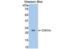 Western Blotting (WB) image for anti-Hemoglobin beta (HBB) (AA 1-147) antibody (ABIN1175987)
