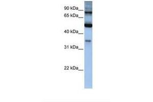 Image no. 1 for anti-Inositol Polyphosphate-5-Phosphatase, 75kDa (INPP5B) (AA 614-663) antibody (ABIN6738990) (INPP5B Antikörper  (AA 614-663))