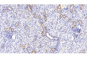 Detection of NOG in Human Kidney Tissue using Polyclonal Antibody to Noggin (NOG) (NOG Antikörper  (AA 28-232))