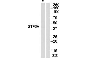 Western blot analysis of extracts from Jurkat cells, using GTF3A antibody. (GTF3A Antikörper  (Internal Region))