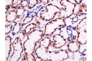 Immunohistochemistry (Paraffin-embedded Sections) (IHC (p)) image for anti-Fibronectin (AA 1201-1300) antibody (ABIN671646)