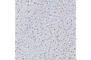 IHC analysis of STAG2 using anti-STAG2 antibody (ABIN7602420).