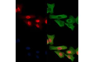 Phospho-Calsenilin/KCNIP3 (Ser63) Antibody staining A549 cells(H2O2 treatment) by IF/ICC.