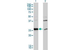 Western Blot analysis of DNAJB6 expression in transfected 293T cell line by DNAJB6 monoclonal antibody (M01), clone 2C11-C1. (DNAJB6 Antikörper  (AA 1-241))