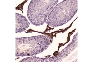 IHC testing of FFPE mouse testis tissue with Cyp17a1 antibody at 2ug/ml. (CYP17A1 Antikörper  (AA 80-363))
