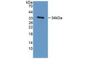 Detection of Recombinant MAPRE1, Human using Polyclonal Antibody to Microtubule Associated Protein RP/EB Family, Member 1 (MAPRE1) (MAPRE1 Antikörper  (AA 2-268))