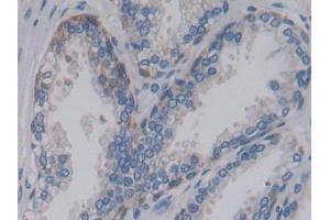 Used in DAB staining on fromalin fixed paraffin-embedded Liver tissue (PCSK9 Antikörper  (AA 156-461))