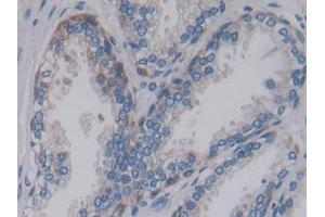 Used in DAB staining on fromalin fixed paraffin-embedded Liver tissue