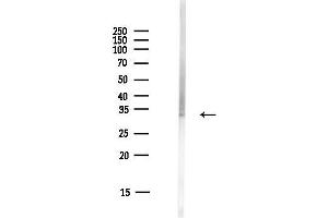 anti-Homeobox C11 (HOXC11) (Internal Region) antibody