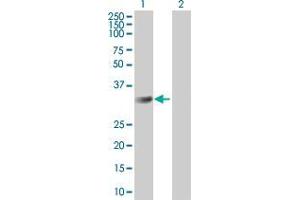 Western Blotting (WB) image for CMTM2 293T Cell Transient Overexpression Lysate(Denatured) (ABIN1338856)