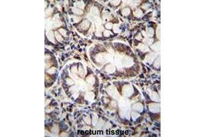 anti-Calcium Channel, Voltage-Dependent, gamma Subunit 8 (CACNG8) (AA 97-127), (N-Term) antibody