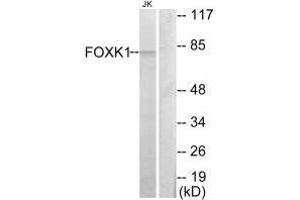 Western blot analysis of extracts from Jurkat cells, using FOXK1 antibody. (Foxk1 Antikörper  (C-Term))