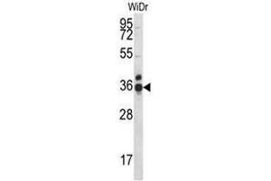 CCDC90B Antibody (Center) western blot analysis in WiDr cell line lysates (35µg/lane). (CCDC90B Antikörper  (Middle Region))
