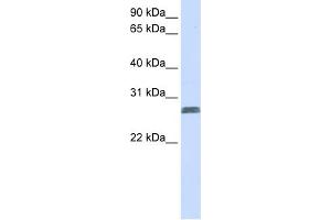 WB Suggested Anti-TMEM51 Antibody Titration:  0. (TMEM51 Antikörper  (N-Term))