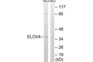 Western Blotting (WB) image for anti-ELOVL Fatty Acid Elongase 4 (ELOVL4) (Internal Region) antibody (ABIN1851294) (ELOVL4 Antikörper  (Internal Region))
