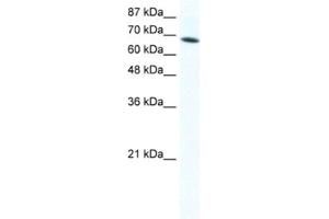 Western Blotting (WB) image for anti-DEAD (Asp-Glu-Ala-Asp) Box Polypeptide 1 (DDX1) antibody (ABIN2461580) (DDX1 Antikörper)