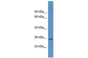 Western Blotting (WB) image for anti-Junctophilin 4 (JPH4) (C-Term) antibody (ABIN2788386) (Junctophilin 4 Antikörper  (C-Term))
