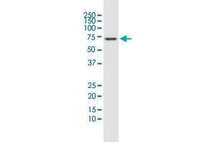 Western Blotting (WB) image for anti-PDZ and LIM Domain 5 (PDLIM5) (AA 1-596) antibody (ABIN564628)
