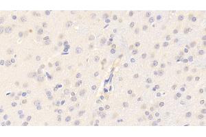 Detection of CYPA in Rat Cerebrum Tissue using Polyclonal Antibody to Cyclophilin A (CYPA) (PPIA Antikörper  (AA 2-164))