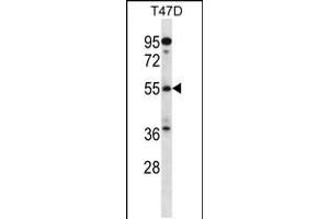 Western blot analysis in T47D cell line lysates (35ug/lane). (ARFGAP3 Antikörper  (C-Term))