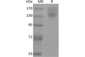 Western Blotting (WB) image for Leptin Receptor (LEPR) protein (mFc Tag) (ABIN7320895) (Leptin Receptor Protein (LEPR) (mFc Tag))