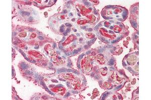 Anti-Ceruloplasmin antibody IHC of human placenta. (Ceruloplasmin Antikörper)