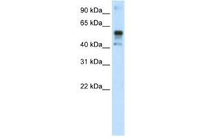 WB Suggested Anti-NFE2L2 Antibody Titration:  1. (NRF2 Antikörper  (C-Term))