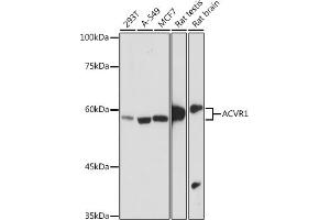 Western blot analysis of extracts of various cell lines, using  antibody (ABIN7265415) at 1:1000 dilution. (ACVR1 Antikörper)