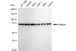 Western blotting analysis using Radixin antibody (ABIN7800123).