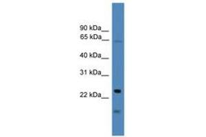 Image no. 1 for anti-TIMP Metallopeptidase Inhibitor 4 (TIMP4) (AA 101-150) antibody (ABIN6745268)