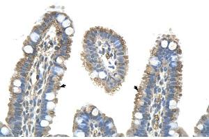 Immunohistochemistry (IHC) image for anti-Pannexin 1 (PANX1) (Middle Region) antibody (ABIN2775573)
