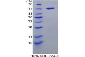 SDS-PAGE analysis of Rat aHSP Protein. (aHSP Protein)