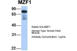 Host: Rabbit Target Name: MZF1 Sample Type: Human Fetal Muscle Antibody Dilution: 1. (MZF1 Antikörper  (N-Term))