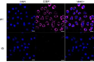 anti-GTPase Activating Protein (SH3 Domain) Binding Protein 1 (G3BP1) antibody