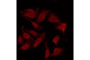 ABIN6275958 staining HuvEc by IF/ICC. (GPR151 Antikörper  (C-Term))