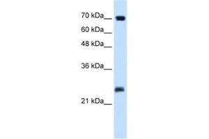Western Blotting (WB) image for anti-SERTA Domain Containing 1 (SERTAD1) antibody (ABIN2460914) (SERTAD1 Antikörper)