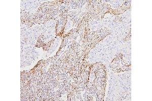 IHC analysis of FLNA using anti-FLNA antibody (ABIN7601782).