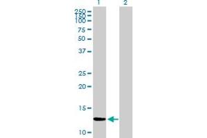 Western Blot analysis of ZNF343 expression in transfected 293T cell line by ZNF343 MaxPab polyclonal antibody. (ZNF343 Antikörper  (AA 1-118))