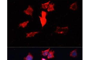 Immunofluorescence analysis of HeLa cells using CALM3 Polyclonal Antibody at dilution of 1:100. (Calmodulin 3 Antikörper)