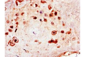 Immunohistochemistry of paraffin-embedded human placenta tissue using ABIN7150181 at dilution of 1:100 (MCM8 Antikörper  (AA 1-67))