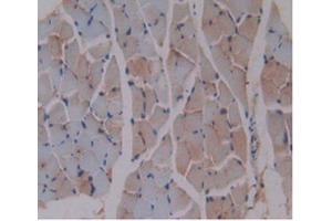DAB staining on IHC-P Samples:Mouse Skeletal Muscle Tissue (beta-2 Microglobulin Antikörper  (AA 22-119))