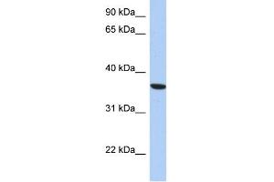 WB Suggested Anti-PSTK Antibody Titration: 0. (PSTK Antikörper  (Middle Region))