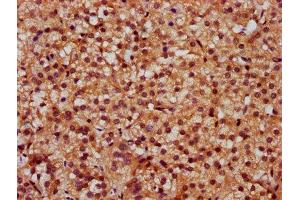 IHC image of ABIN7170935 diluted at 1:300 and staining in paraffin-embedded human adrenal gland tissue performed on a Leica BondTM system. (SLC26A2 Antikörper  (AA 614-739))