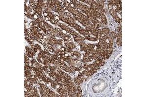 Immunohistochemical staining of human liver with ZCCHC24 polyclonal antibody  shows strong cytoplasmic positivity in hepatocytes while bile duct cells were negative at 1:200-1:500 dilution. (ZCCHC24 Antikörper)