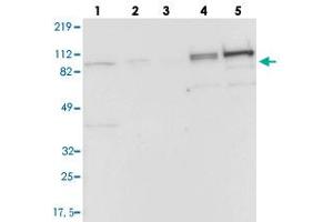 Western blot analysis of Lane 1: RT-4, Lane 2: EFO-21, Lane 3: A-431, Lane 4: Liver, Lane 5: Tonsil with CFB polyclonal antibody . (Complement Factor B Antikörper)