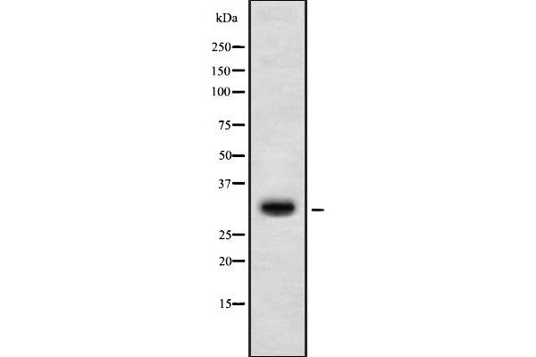 HOXD10 Antikörper  (Internal Region)