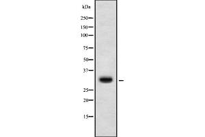 Western blot analysis of HoxD10 using K562 whole cell lysates (HOXD10 Antikörper  (Internal Region))