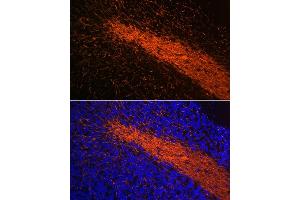 Immunofluorescence analysis of mouse brain using Myelin Basic Protein Rabbit mAb (ABIN7268431) at dilution of 1:100 (40x lens). (MBP Antikörper)